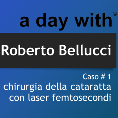 Chirurgia della cataratta con laser femtosecondi – Roberto Bellucci – Caso#1